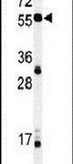 NOB1 Antibody in Western Blot (WB)