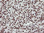 NONO Antibody in Immunohistochemistry (Paraffin) (IHC (P))