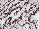 NONO Antibody in Immunohistochemistry (Paraffin) (IHC (P))