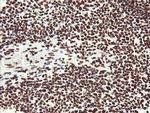 NONO Antibody in Immunohistochemistry (Paraffin) (IHC (P))