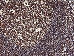 NONO Antibody in Immunohistochemistry (Paraffin) (IHC (P))