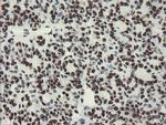 NONO Antibody in Immunohistochemistry (Paraffin) (IHC (P))