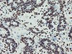 NONO Antibody in Immunohistochemistry (Paraffin) (IHC (P))