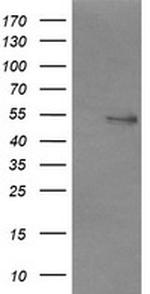 NONO Antibody in Western Blot (WB)