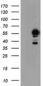 NONO Antibody in Western Blot (WB)