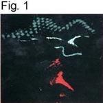 uNOS Polyclonal Antibody