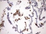 NOTCH1 Antibody in Immunohistochemistry (Paraffin) (IHC (P))