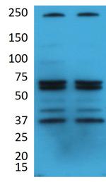 NOTCH4 Antibody in Western Blot (WB)