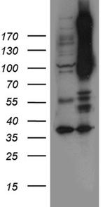 NOTCH4 Antibody in Western Blot (WB)
