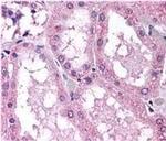 NOX4 Antibody in Immunohistochemistry (IHC)