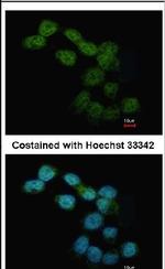 NOX4 Antibody in Immunocytochemistry (ICC/IF)