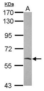 NOX4 Antibody in Western Blot (WB)