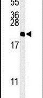 NAP1L5 Antibody in Western Blot (WB)