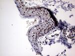 NPAS1 Antibody in Immunohistochemistry (Paraffin) (IHC (P))