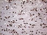 NPAS1 Antibody in Immunohistochemistry (Paraffin) (IHC (P))