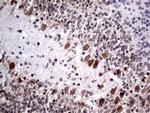NPAS1 Antibody in Immunohistochemistry (Paraffin) (IHC (P))