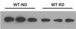 NPC1L1 Antibody in Western Blot (WB)