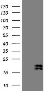NPPB Antibody in Western Blot (WB)