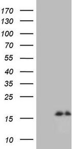 NPPB Antibody in Western Blot (WB)