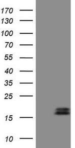 NPPB Antibody in Western Blot (WB)