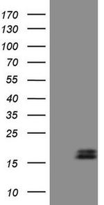 NPPB Antibody in Western Blot (WB)