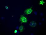 NPR3 Antibody in Immunocytochemistry (ICC/IF)