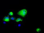 NPR3 Antibody in Immunocytochemistry (ICC/IF)