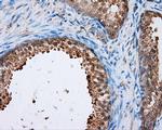 NPR3 Antibody in Immunohistochemistry (Paraffin) (IHC (P))