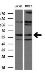 NPR3 Antibody in Western Blot (WB)
