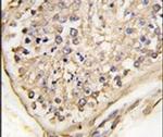 NPTX2 Antibody in Immunohistochemistry (IHC)