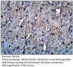 NPY2R Polyclonal Antibody