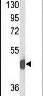 NPY2R Antibody in Western Blot (WB)