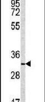 NQO1 Antibody in Western Blot (WB)