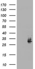NQO2 Antibody in Western Blot (WB)