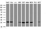 NQO2 Antibody in Western Blot (WB)