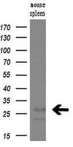 NQO2 Antibody in Western Blot (WB)