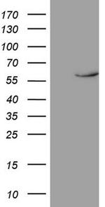 NR1D2 Antibody in Western Blot (WB)