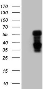 NR1D2 Antibody in Western Blot (WB)