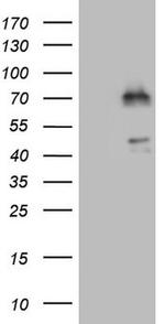 NR1D2 Antibody in Western Blot (WB)
