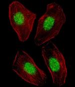 LXR alpha Antibody in Immunocytochemistry (ICC/IF)