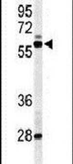 LXR alpha Antibody in Western Blot (WB)