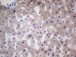 NR1I3 Antibody in Immunohistochemistry (Paraffin) (IHC (P))