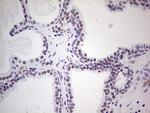 NR1I3 Antibody in Immunohistochemistry (Paraffin) (IHC (P))