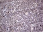 NR1I3 Antibody in Immunohistochemistry (Paraffin) (IHC (P))
