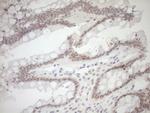 NR1I3 Antibody in Immunohistochemistry (Paraffin) (IHC (P))