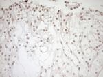 NR1I3 Antibody in Immunohistochemistry (Paraffin) (IHC (P))