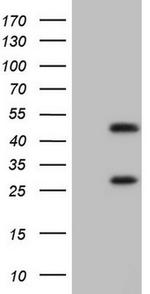 NR1I3 Antibody in Western Blot (WB)