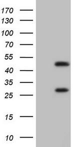 NR1I3 Antibody in Western Blot (WB)