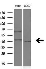NR1I3 Antibody in Western Blot (WB)
