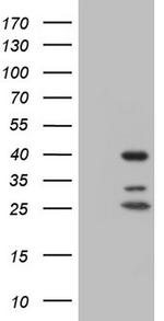 NR1I3 Antibody in Western Blot (WB)
